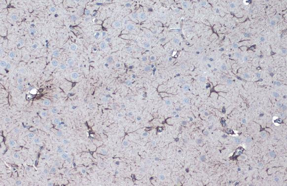 GFAP Antibody in Immunohistochemistry (Paraffin) (IHC (P))