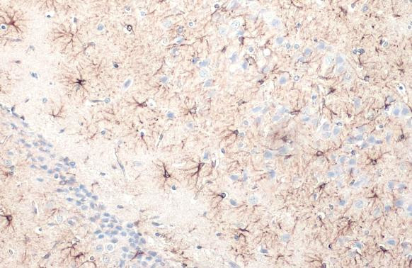 GFAP Antibody in Immunohistochemistry (Paraffin) (IHC (P))