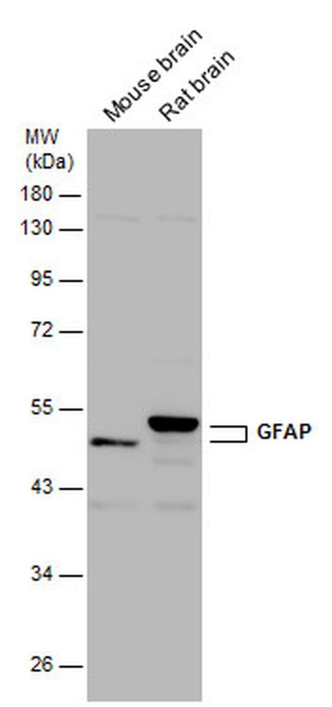 GFAP Antibody in Western Blot (WB)