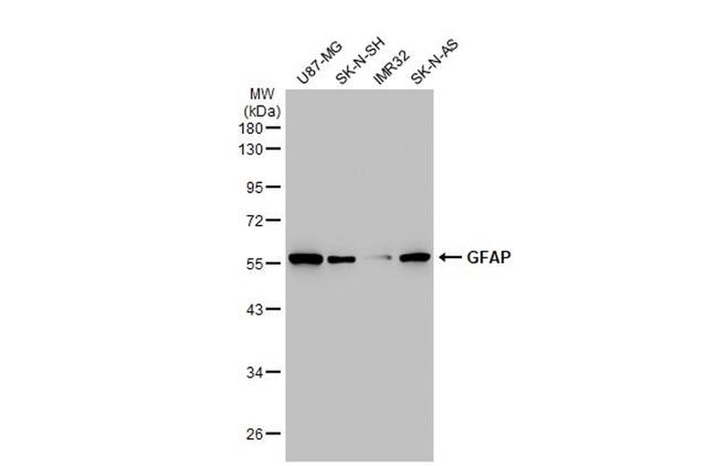 GFAP Antibody in Western Blot (WB)