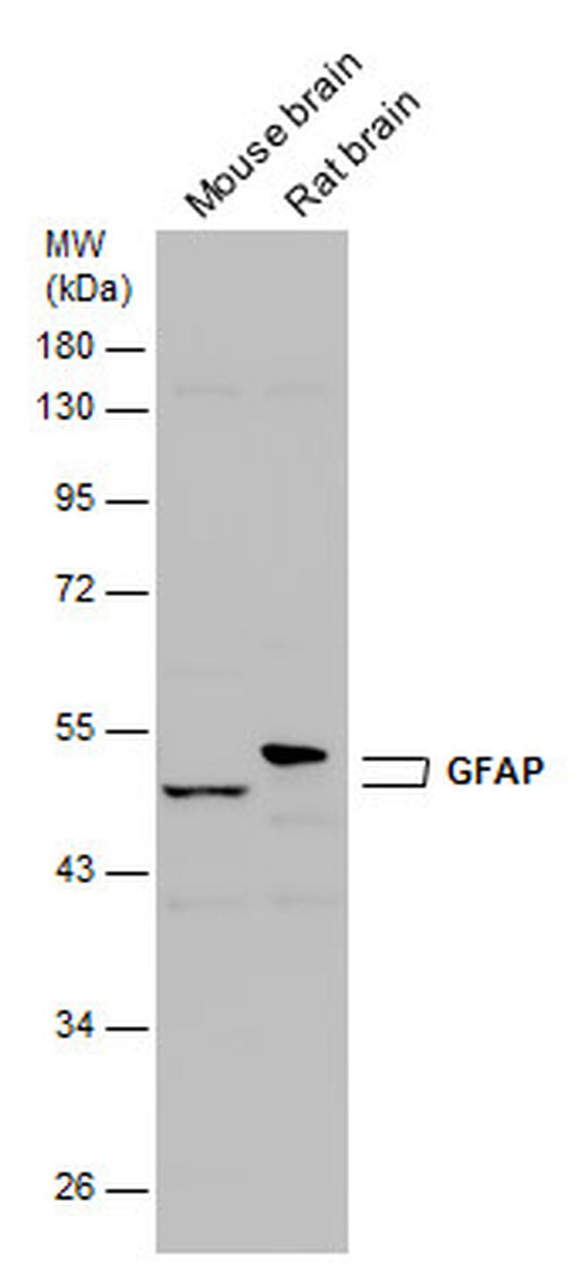 GFAP Antibody in Western Blot (WB)