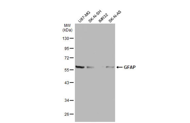 GFAP Antibody in Western Blot (WB)