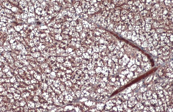 Leptin Antibody in Immunohistochemistry (Paraffin) (IHC (P))