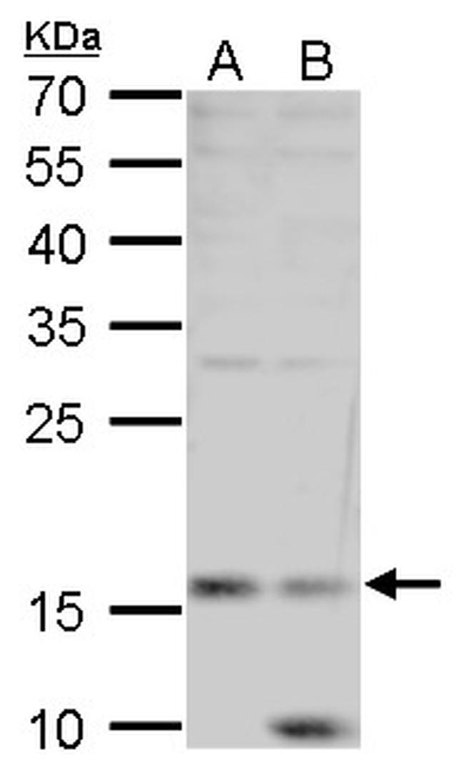 Leptin Antibody in Western Blot (WB)