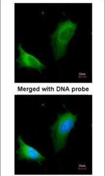 Arginase 1 Antibody in Immunocytochemistry (ICC/IF)