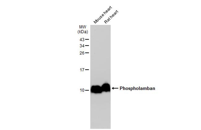 Phospholamban Antibody in Western Blot (WB)