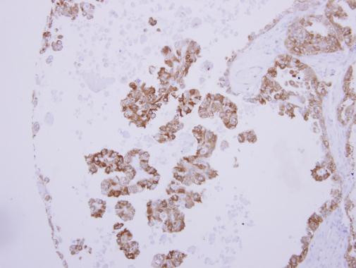 ANP Antibody in Immunohistochemistry (Paraffin) (IHC (P))