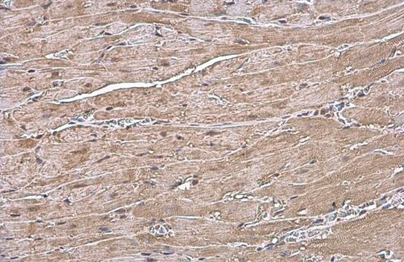 ANP Antibody in Immunohistochemistry (Paraffin) (IHC (P))