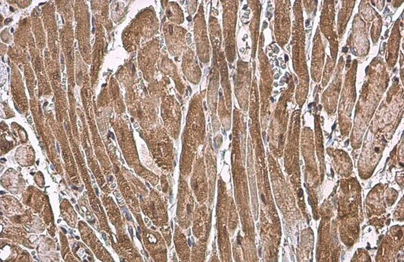 ANP Antibody in Immunohistochemistry (Paraffin) (IHC (P))