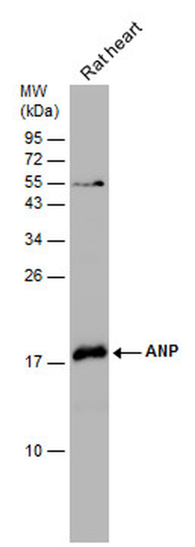 ANP Antibody in Western Blot (WB)