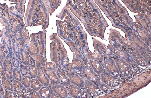 beta Actin Antibody in Immunohistochemistry (Paraffin) (IHC (P))