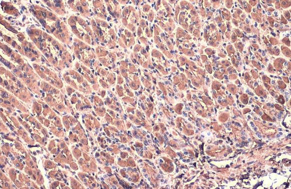 beta Actin Antibody in Immunohistochemistry (Paraffin) (IHC (P))