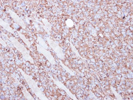 beta Actin Antibody in Immunohistochemistry (Paraffin) (IHC (P))