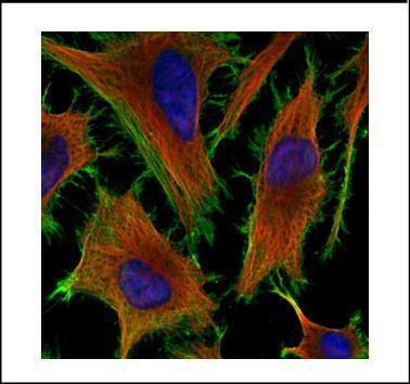 beta Actin Antibody in Immunocytochemistry (ICC/IF)