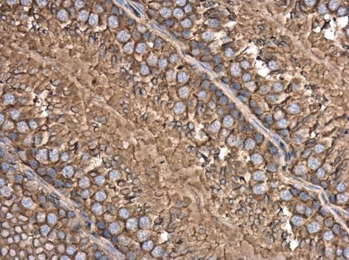 beta Actin Antibody in Immunohistochemistry (Paraffin) (IHC (P))