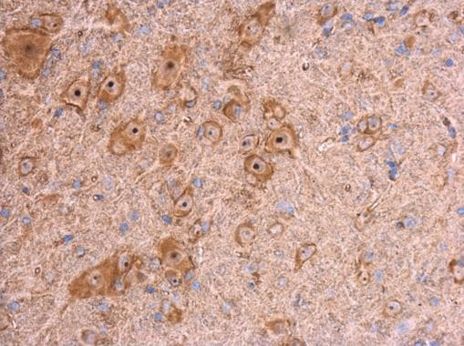 beta Actin Antibody in Immunohistochemistry (Paraffin) (IHC (P))