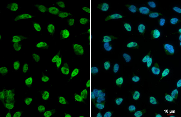 HDAC2 Antibody in Immunocytochemistry (ICC/IF)