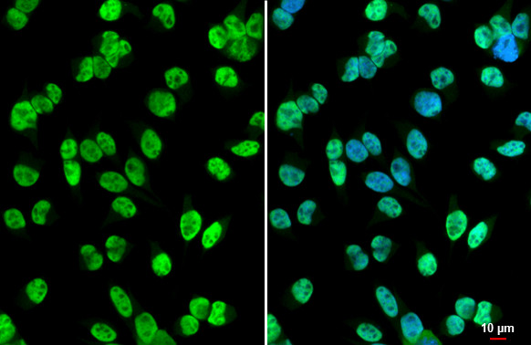 HDAC2 Antibody in Immunocytochemistry (ICC/IF)