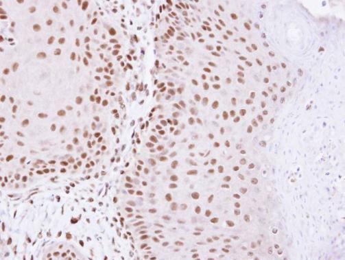 HDAC2 Antibody in Immunohistochemistry (Paraffin) (IHC (P))