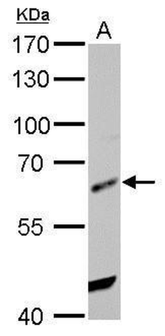 HDAC2 Antibody in Western Blot (WB)