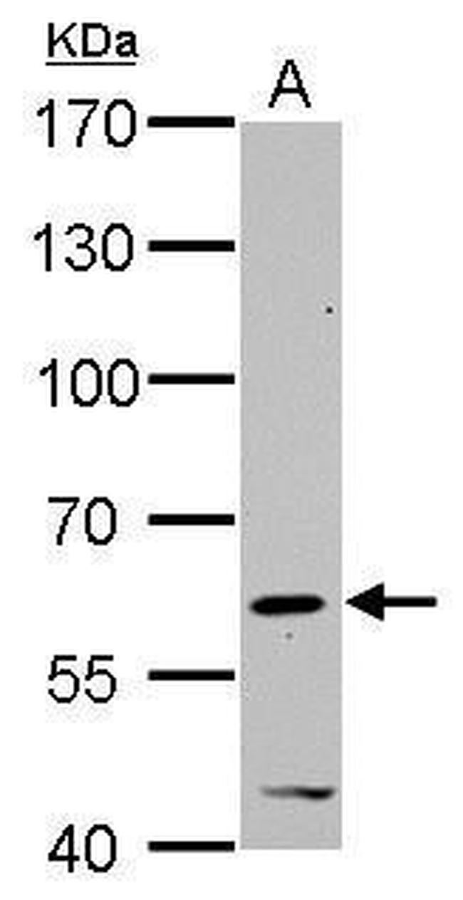 HDAC2 Antibody in Western Blot (WB)