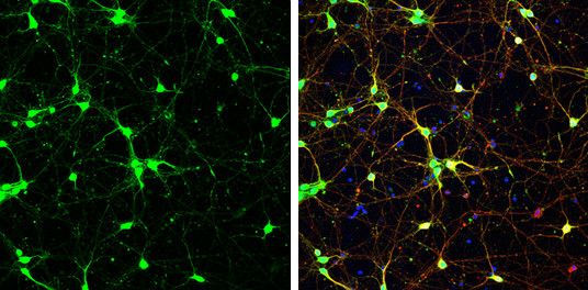 PGP9.5 Antibody in Immunocytochemistry (ICC/IF)