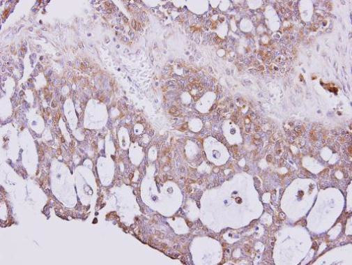 PGP9.5 Antibody in Immunohistochemistry (Paraffin) (IHC (P))