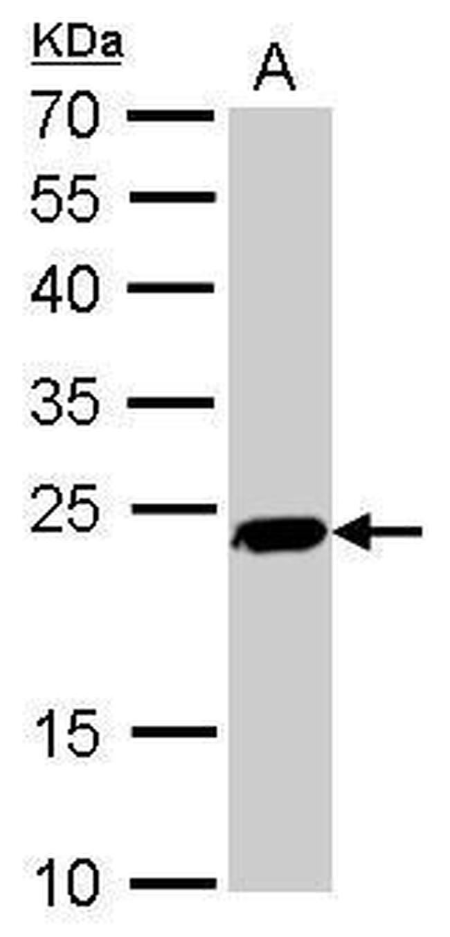 PGP9.5 Antibody in Western Blot (WB)