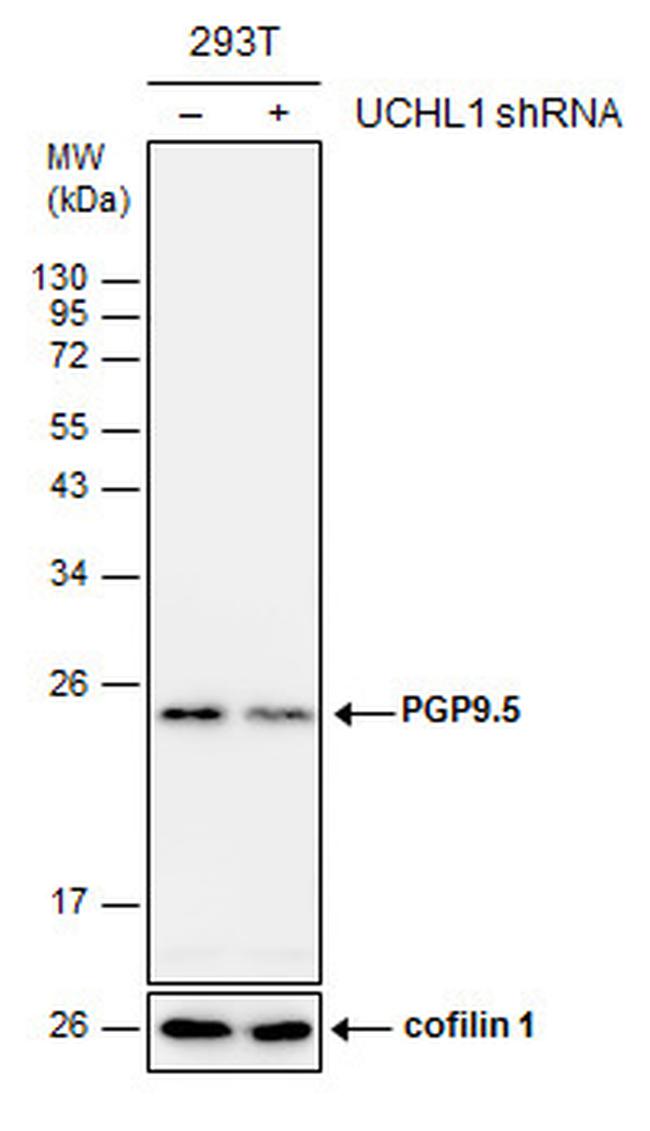 PGP9.5 Antibody in Western Blot (WB)