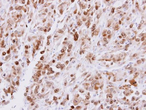 CDT1 Antibody in Immunohistochemistry (Paraffin) (IHC (P))