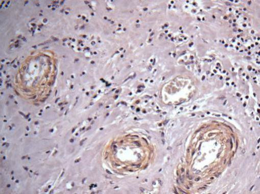 Vinculin Antibody in Immunohistochemistry (Paraffin) (IHC (P))