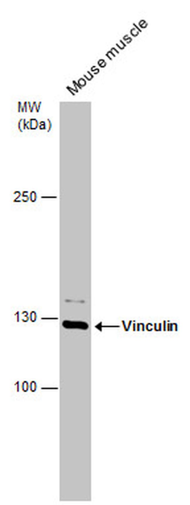 Vinculin Antibody in Western Blot (WB)