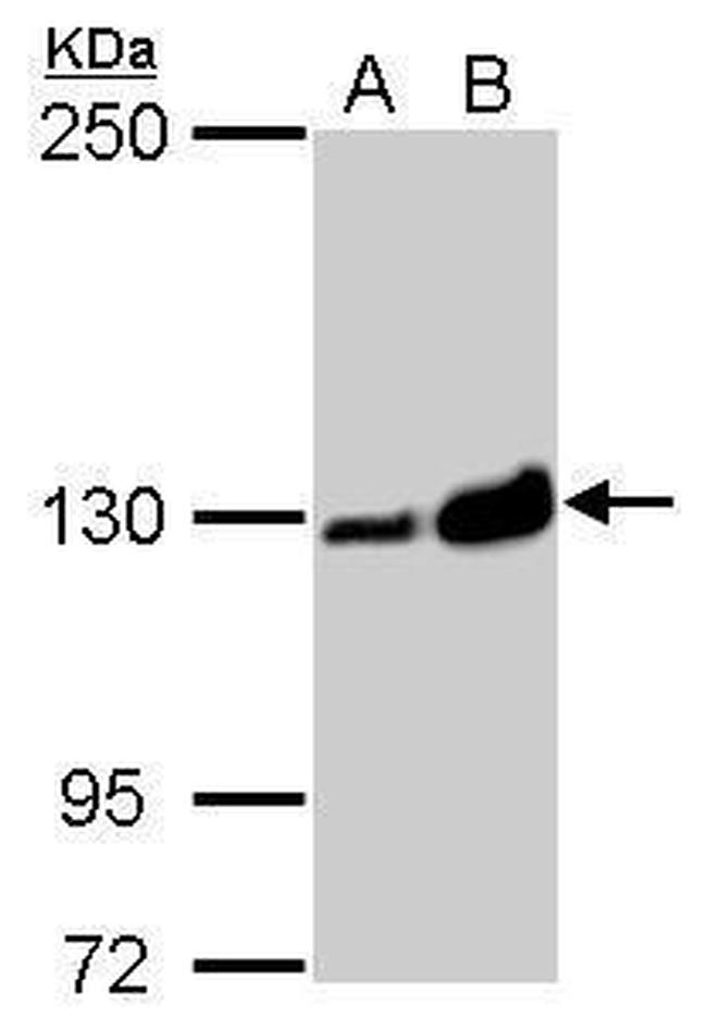 Vinculin Antibody in Western Blot (WB)