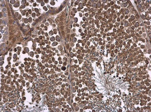 NPR3 Antibody in Immunohistochemistry (Paraffin) (IHC (P))