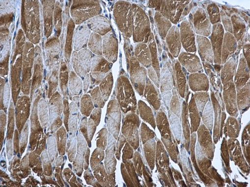 PUS1 Antibody in Immunohistochemistry (Paraffin) (IHC (P))