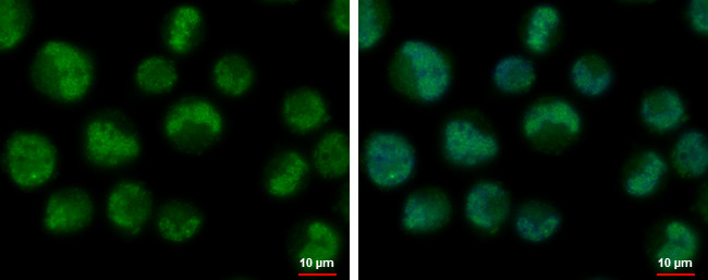 TCF3 Antibody in Immunocytochemistry (ICC/IF)