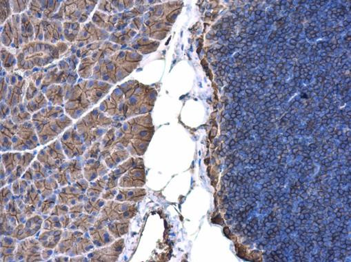 beta Actin Antibody in Immunohistochemistry (Paraffin) (IHC (P))