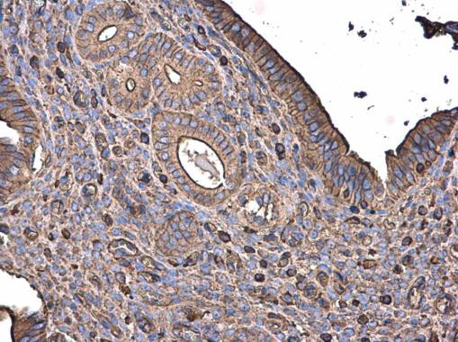 beta Actin Antibody in Immunohistochemistry (Paraffin) (IHC (P))