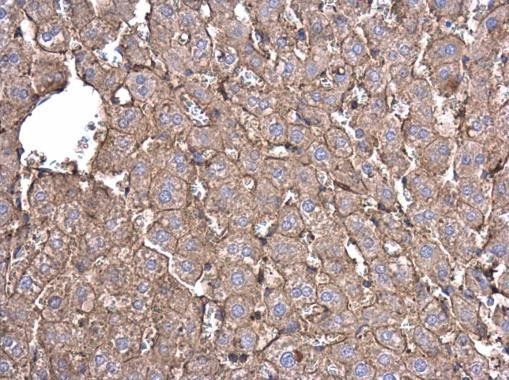 beta Actin Antibody in Immunohistochemistry (Paraffin) (IHC (P))