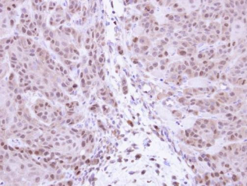 NFkB p105 Antibody in Immunohistochemistry (Paraffin) (IHC (P))