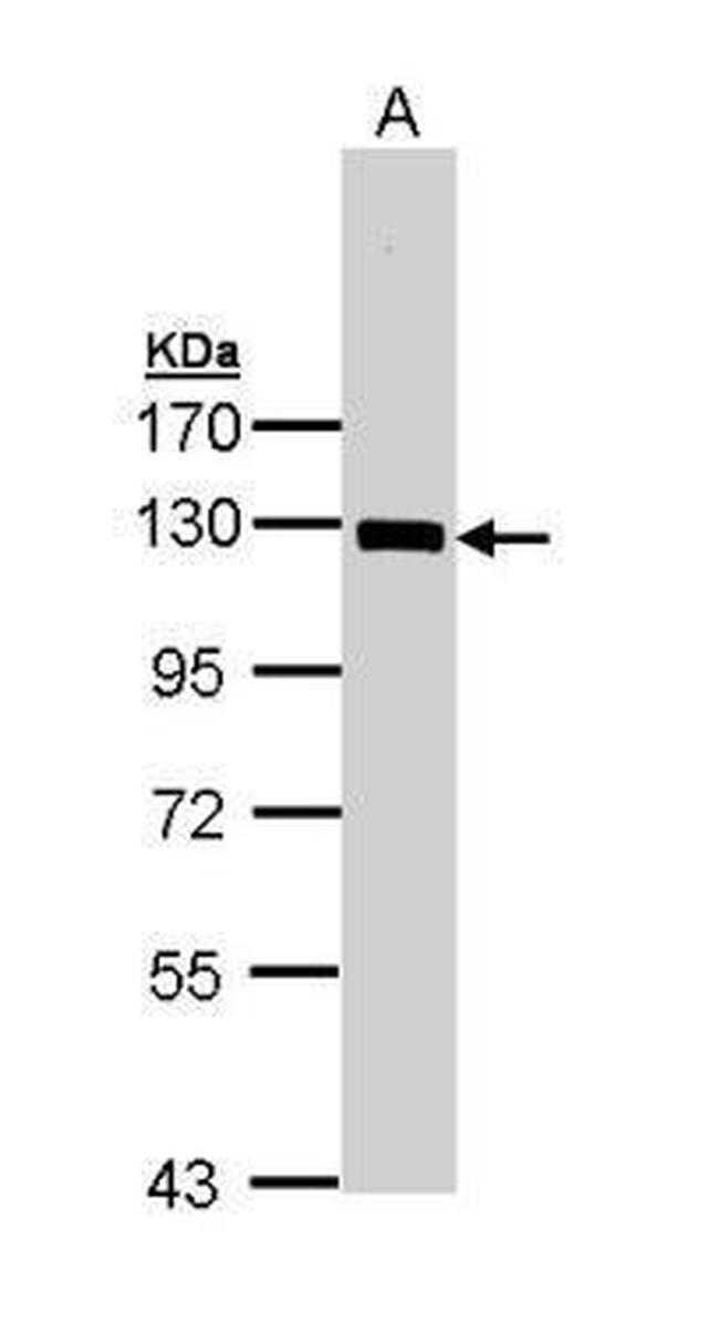 NFkB p105 Antibody in Western Blot (WB)