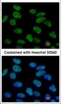 STAT3 Antibody in Immunocytochemistry (ICC/IF)