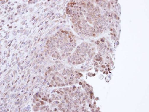 STAT3 Antibody in Immunohistochemistry (Paraffin) (IHC (P))