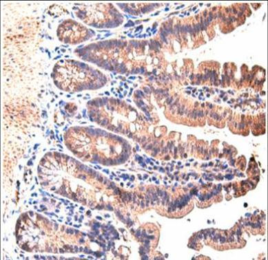 STAT3 Antibody in Immunohistochemistry (Paraffin) (IHC (P))