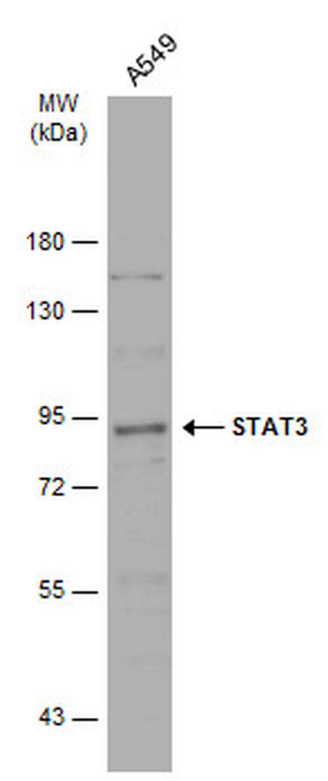 STAT3 Antibody in Western Blot (WB)