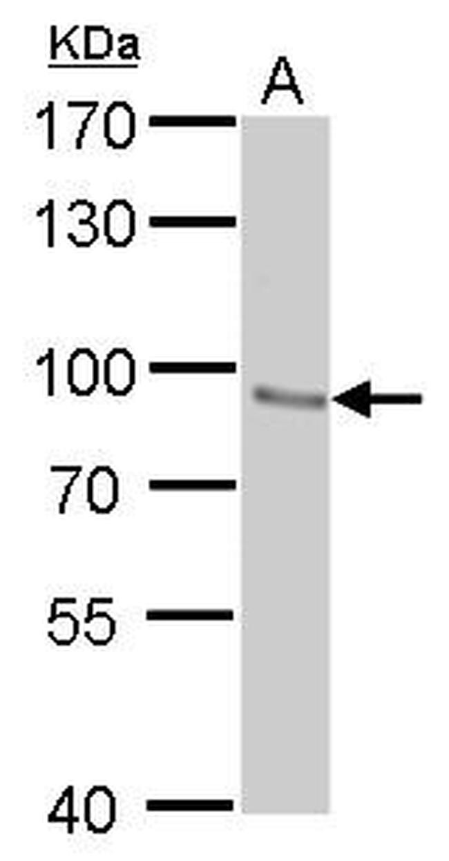 STAT3 Antibody in Western Blot (WB)