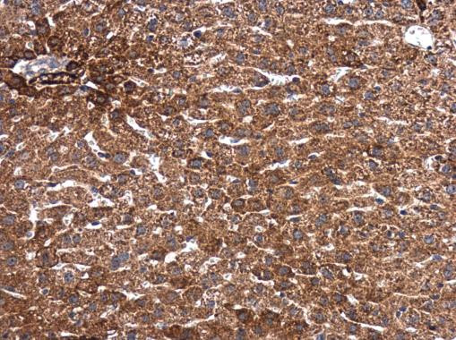 SMAD2 Antibody in Immunohistochemistry (Paraffin) (IHC (P))