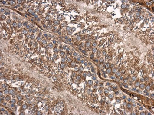 SMAD2 Antibody in Immunohistochemistry (Paraffin) (IHC (P))