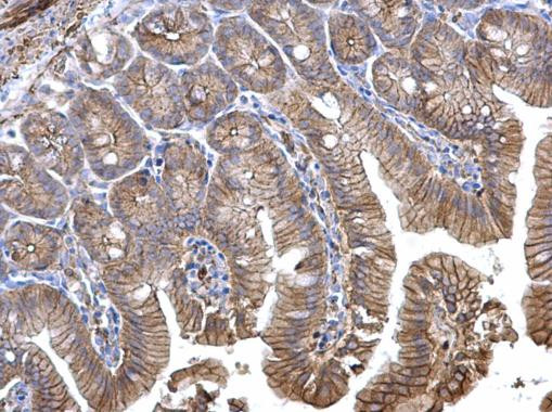 Catenin alpha-1 Antibody in Immunohistochemistry (Paraffin) (IHC (P))