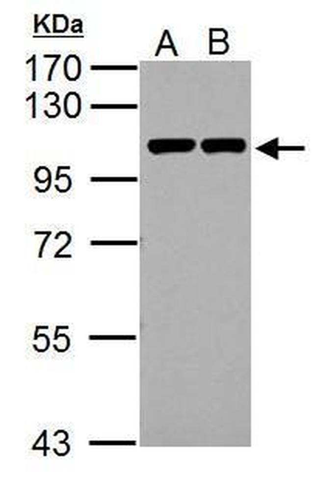 Catenin alpha-1 Antibody in Western Blot (WB)